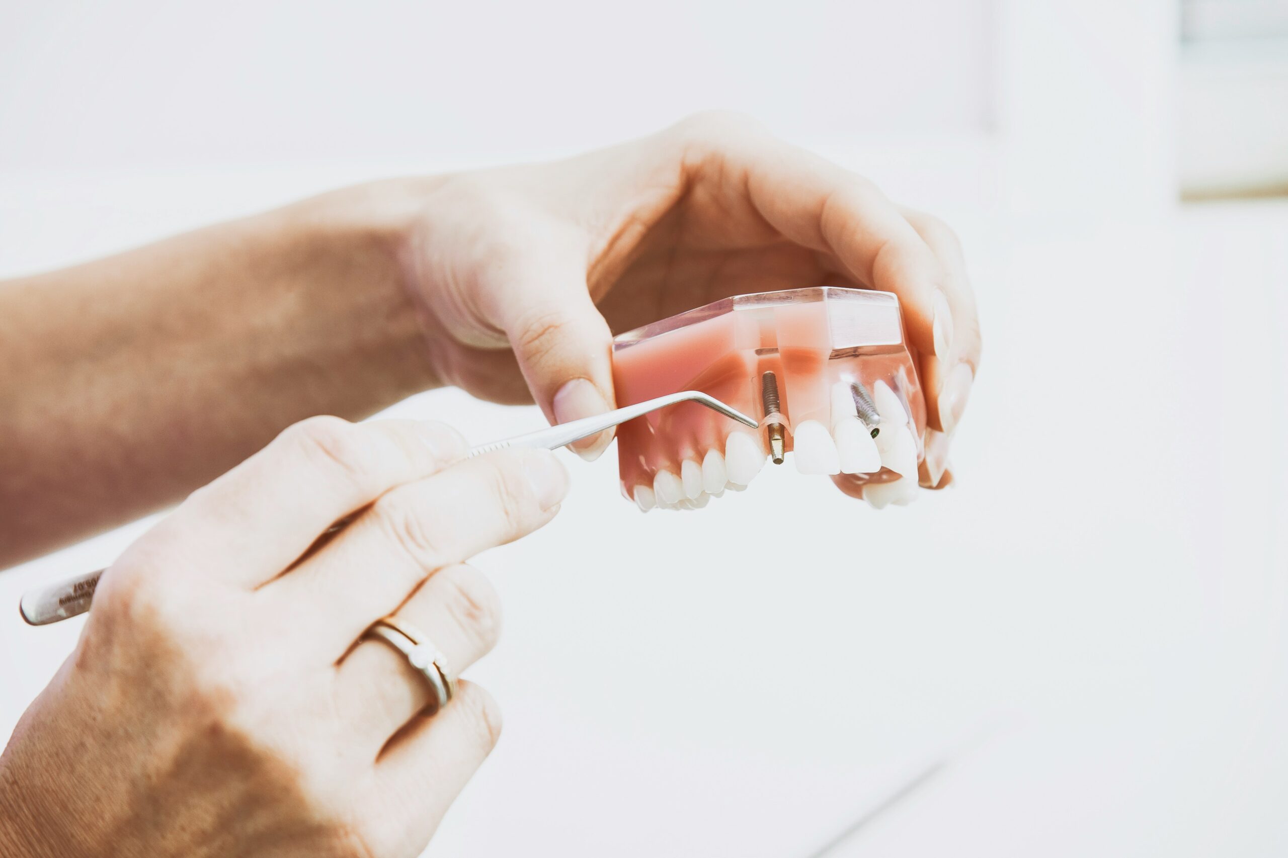 how much is a dental implant