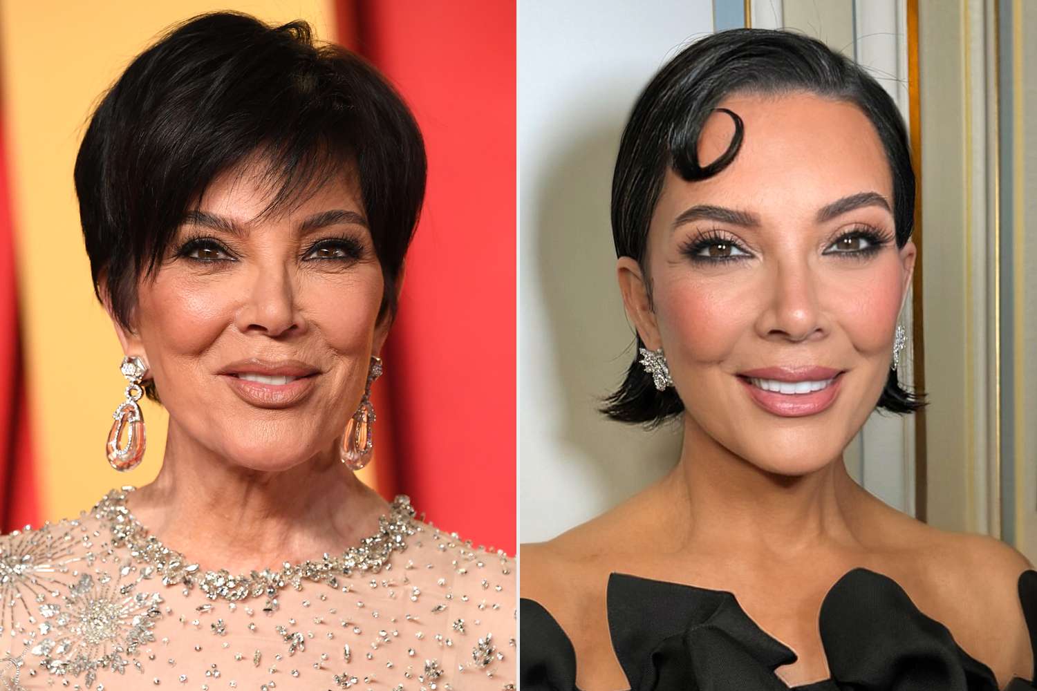 kris jenner face lift